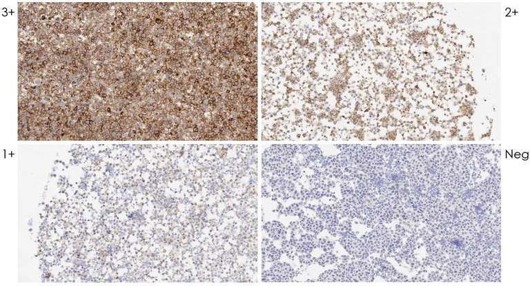 Immunohistochemistry (Formalin/PFA-fixed paraffin-embedded sections) - Anti-PD-L1 antibody [73-10] - Low endotoxin, Azide free (AB246698)