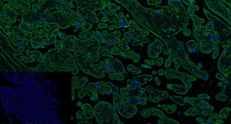 Immunohistochemistry (Formalin/PFA-fixed paraffin-embedded sections) - Anti-PD-L1 antibody [73-10] - Low endotoxin, Azide free (AB246698)