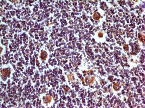Immunohistochemistry (Formalin/PFA-fixed paraffin-embedded sections) - Anti-PD-L1 antibody [ABM4E54] (AB210931)