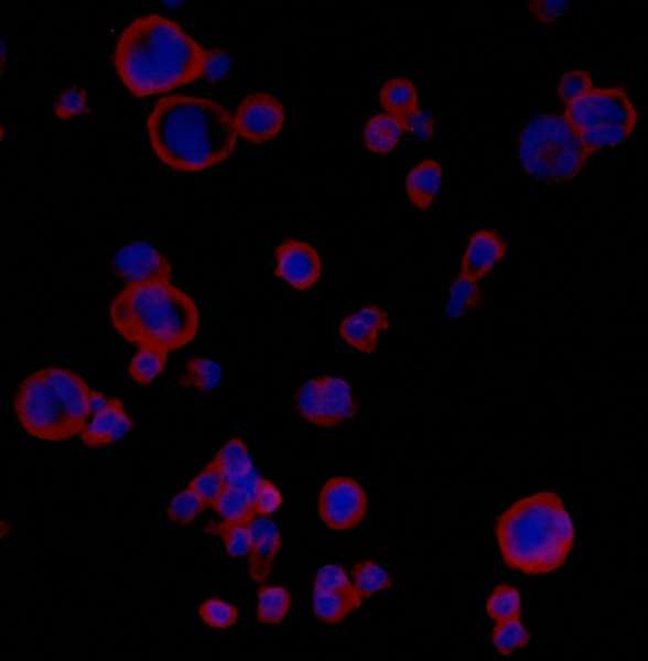 Immunocytochemistry/ Immunofluorescence - Anti-PD-L1 antibody [BLR020E] (ab243877), expandable thumbnail
