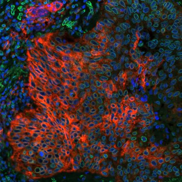 Immunohistochemistry (Formalin/PFA-fixed paraffin-embedded sections) - Anti-PD-L1 antibody [BLR020E] (ab243877), expandable thumbnail