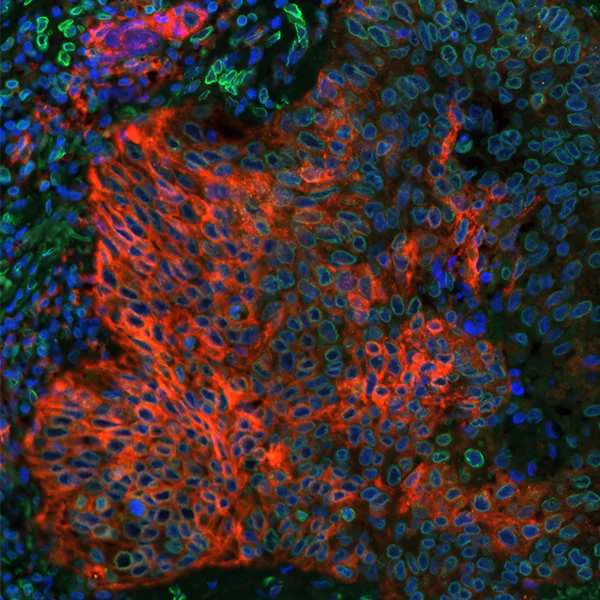 Immunohistochemistry (Formalin/PFA-fixed paraffin-embedded sections) - Anti-PD-L1 antibody [BLR020E] (AB243877)