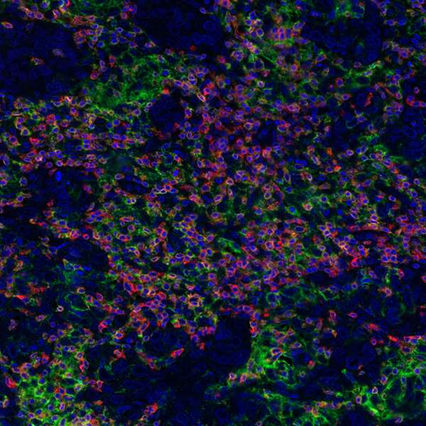 Immunohistochemistry (Formalin/PFA-fixed paraffin-embedded sections) - Anti-PD-L1 antibody [BLR020E] (ab243877), expandable thumbnail