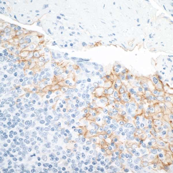 Immunohistochemistry (Formalin/PFA-fixed paraffin-embedded sections) - Anti-PD-L1 antibody [BLR020E] (AB243877), expandable thumbnail