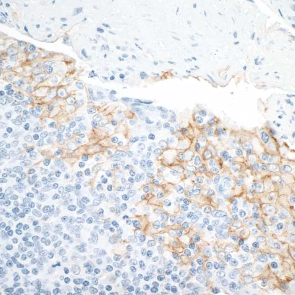 Immunohistochemistry (Formalin/PFA-fixed paraffin-embedded sections) - Anti-PD-L1 antibody [BLR020E] (AB243877)