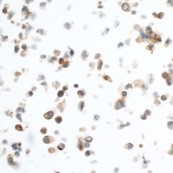 Immunohistochemistry (Formalin/PFA-fixed paraffin-embedded sections) - Anti-PD-L1 antibody [BLR020E] (AB243877), expandable thumbnail