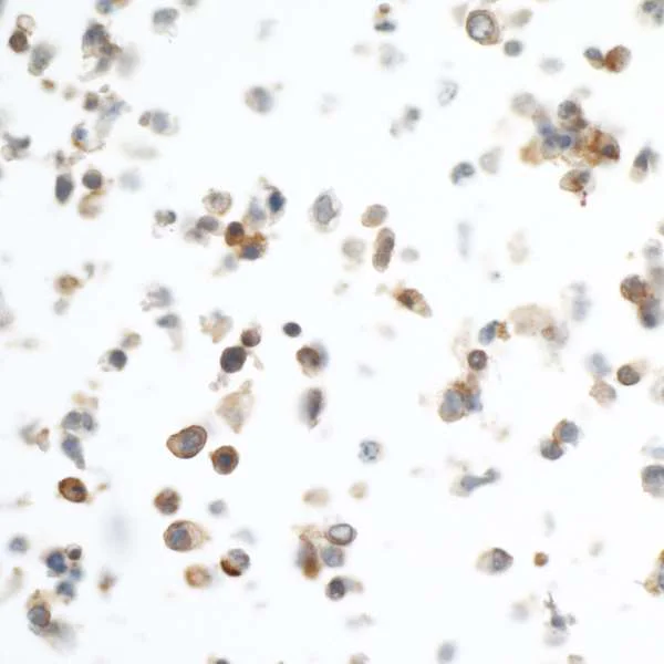 Immunohistochemistry (Formalin/PFA-fixed paraffin-embedded sections) - Anti-PD-L1 antibody [BLR020E] (AB243877)