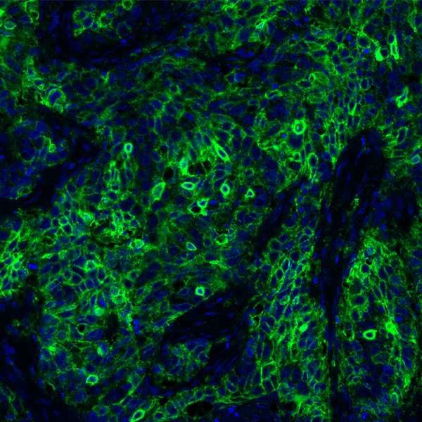 Immunohistochemistry (Formalin/PFA-fixed paraffin-embedded sections) - Anti-PD-L1 antibody [BLR020E] (AB243877), expandable thumbnail