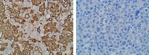 Immunohistochemistry (Formalin/PFA-fixed paraffin-embedded sections) - Anti-PD-L1 antibody [CAL10] (AB237726)