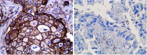 Immunohistochemistry (Formalin/PFA-fixed paraffin-embedded sections) - Anti-PD-L1 antibody [CAL10] (AB237726)