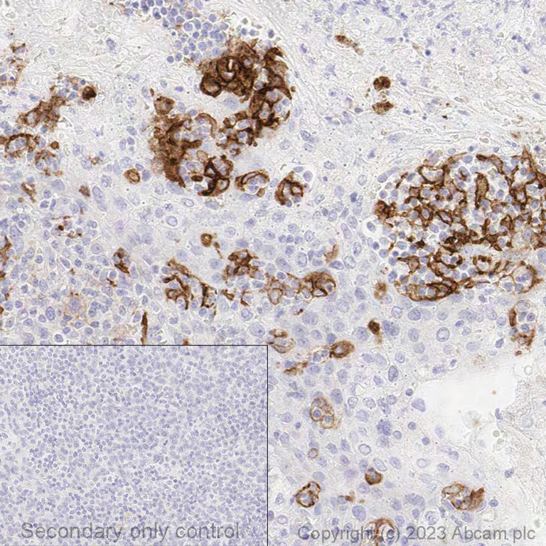 Immunohistochemistry (Formalin/PFA-fixed paraffin-embedded sections) - Anti-PD-L1 antibody [CAL10] (AB237726)