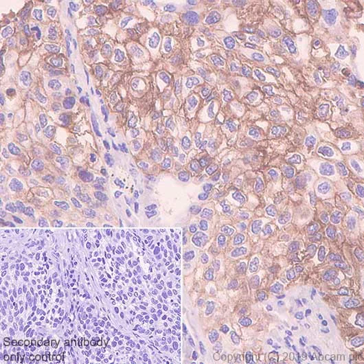 Immunohistochemistry (Formalin/PFA-fixed paraffin-embedded sections) - Anti-PD-L1 antibody [CAL10] - BSA and Azide free (AB251611)
