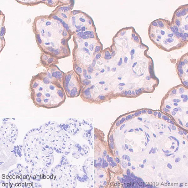 Immunohistochemistry (Formalin/PFA-fixed paraffin-embedded sections) - Anti-PD-L1 antibody [CAL10] - BSA and Azide free (AB251611)