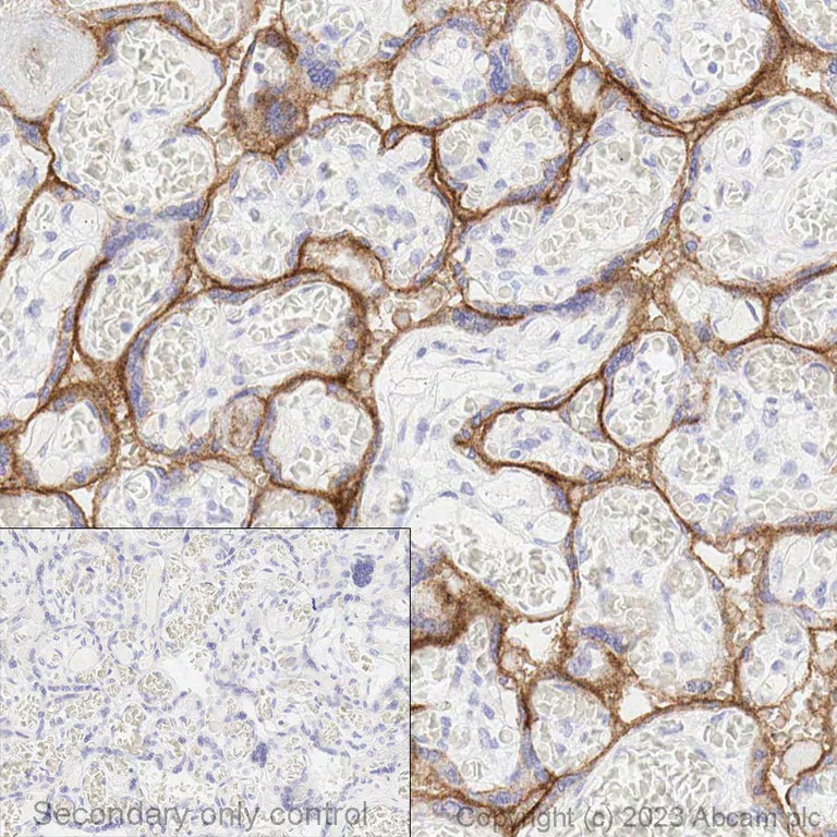 Immunohistochemistry (Formalin/PFA-fixed paraffin-embedded sections) - Anti-PD-L1 antibody [CAL10] - BSA and Azide free (AB251611)