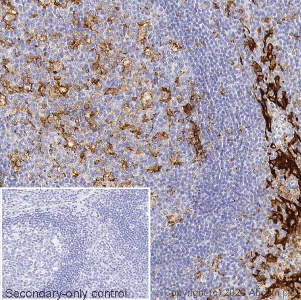 Immunohistochemistry (Formalin/PFA-fixed paraffin-embedded sections) - Anti-PD-L1 antibody [CAL10] - Mouse IgG1 (Chimeric) (AB279292)