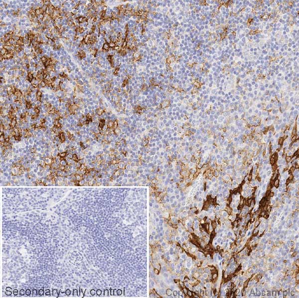 Immunohistochemistry (Formalin/PFA-fixed paraffin-embedded sections) - Anti-PD-L1 antibody [CAL10] - Mouse IgG2a (Chimeric) (AB279293), expandable thumbnail