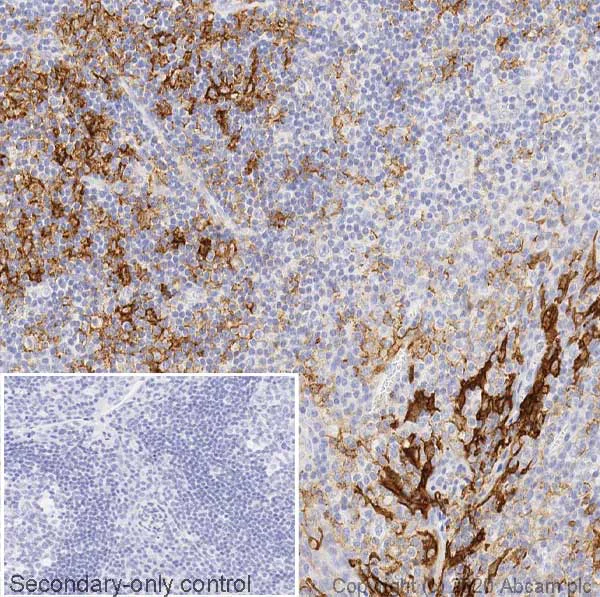 Immunohistochemistry (Formalin/PFA-fixed paraffin-embedded sections) - Anti-PD-L1 antibody [CAL10] - Mouse IgG2a (Chimeric) (AB279293)