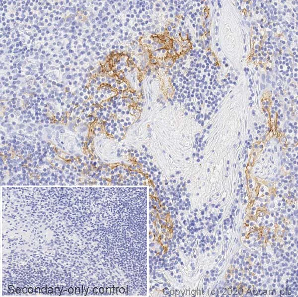 Immunohistochemistry (Formalin/PFA-fixed paraffin-embedded sections) - Anti-PD-L1 antibody [CAL10] - Rat IgG2a (Chimeric) (AB279294)