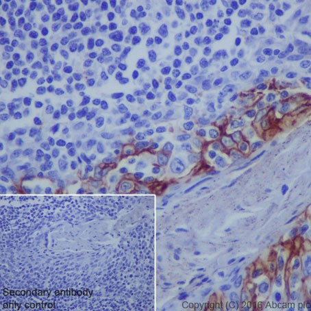 Immunohistochemistry (Formalin/PFA-fixed paraffin-embedded sections) - Anti-PD-L1 antibody [EPR19759] (AB213524), expandable thumbnail