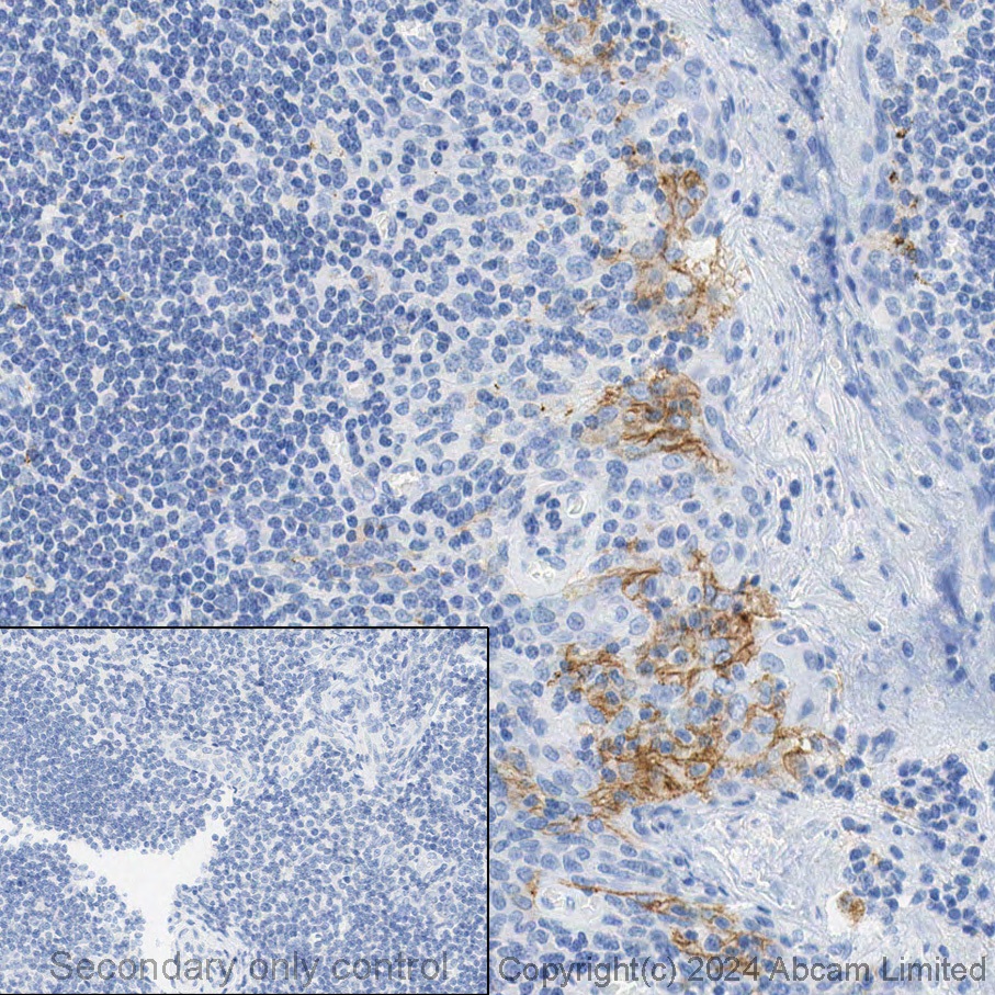 Immunohistochemistry (Formalin/PFA-fixed paraffin-embedded sections) - Anti-PD-L1 antibody [EPR19759] (ab213524), expandable thumbnail