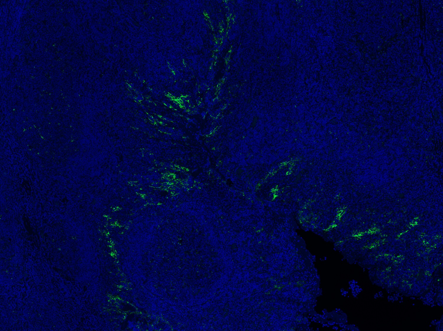Immunohistochemistry (Formalin/PFA-fixed paraffin-embedded sections) - Anti-PD-L1 antibody [EPR19759] (AB213524), expandable thumbnail