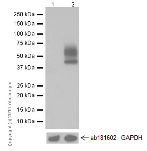 Western blot - Anti-PD-L1 antibody [EPR19759] (AB213524)