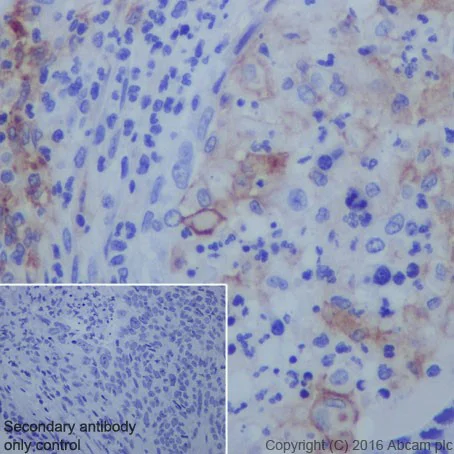 Immunohistochemistry (Formalin/PFA-fixed paraffin-embedded sections) - Anti-PD-L1 antibody [EPR19759] - Low endotoxin, Azide free (AB246695)