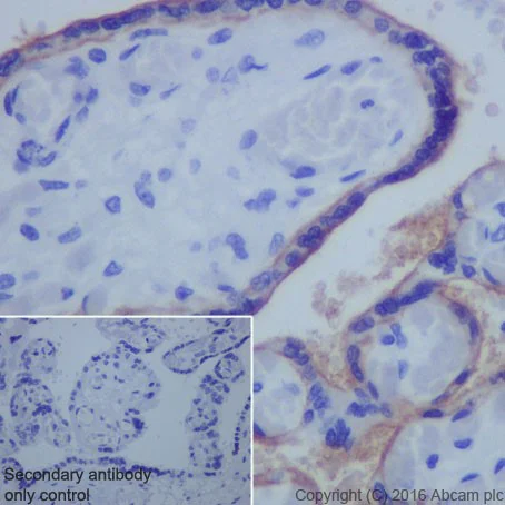 Immunohistochemistry (Formalin/PFA-fixed paraffin-embedded sections) - Anti-PD-L1 antibody [EPR19759] - Low endotoxin, Azide free (AB246695)