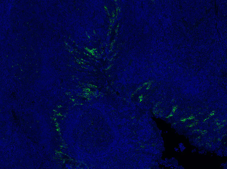 Immunohistochemistry (Formalin/PFA-fixed paraffin-embedded sections) - Anti-PD-L1 antibody [EPR19759] - Low endotoxin, Azide free (AB246695)