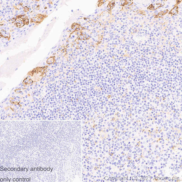 Immunohistochemistry (Formalin/PFA-fixed paraffin-embedded sections) - Anti-PD-L1 antibody [RM1012] - BSA and Azide free (AB283867)