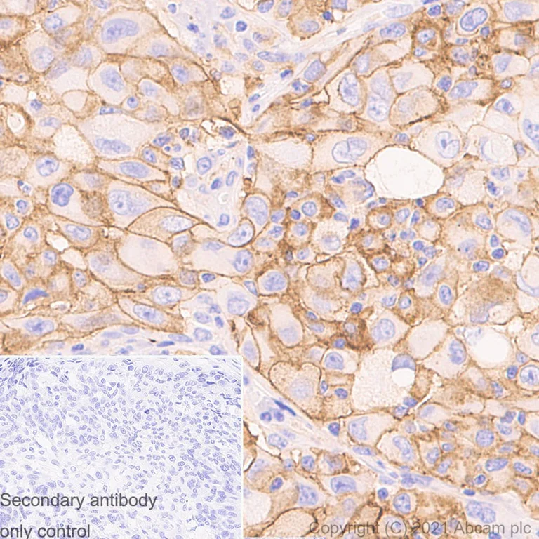 Immunohistochemistry (Formalin/PFA-fixed paraffin-embedded sections) - Anti-PD-L1 antibody [RM1012] - BSA and Azide free (AB283867)