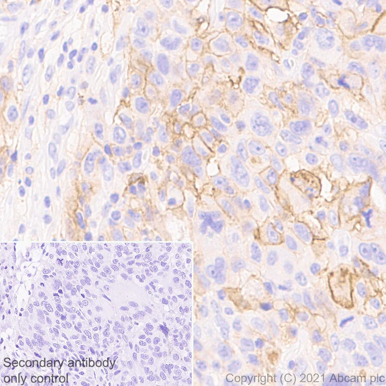 Immunohistochemistry (Formalin/PFA-fixed paraffin-embedded sections) - Anti-PD-L1 antibody [RM1012] - BSA and Azide free (AB283867)