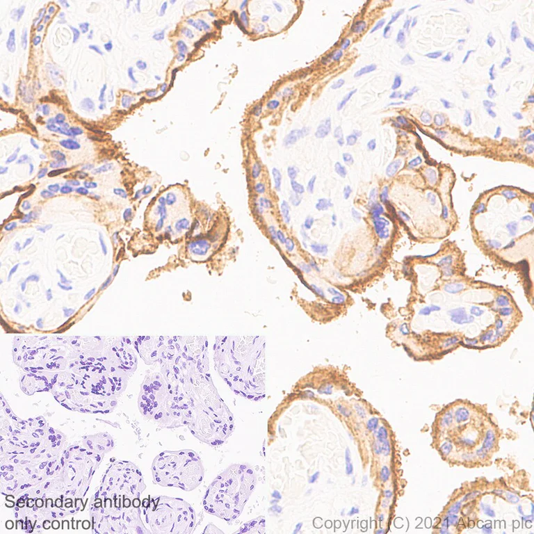 Immunohistochemistry (Formalin/PFA-fixed paraffin-embedded sections) - Anti-PD-L1 antibody [RM1012] - BSA and Azide free (AB283867)
