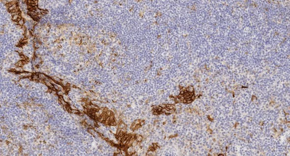 Immunohistochemistry (Formalin/PFA-fixed paraffin-embedded sections) - Anti-PD-L1 antibody [SP142] - C-terminal (AB228462)