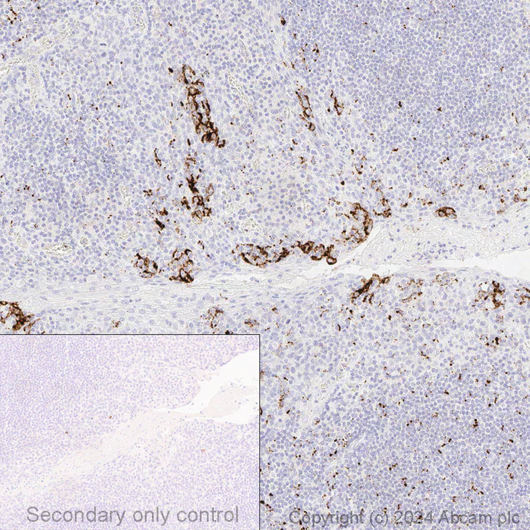 Immunohistochemistry (Formalin/PFA-fixed paraffin-embedded sections) - Anti-PD-L1 antibody [SP142] - C-terminal (AB228462)