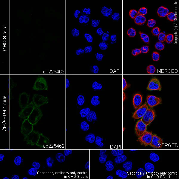 Immunocytochemistry/ Immunofluorescence - Anti-PD-L1 antibody [SP142] - C-terminal, BSA and Azide free (AB236238)