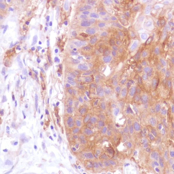 Immunohistochemistry (Formalin/PFA-fixed paraffin-embedded sections) - Anti-PD-L1 antibody [SP142] - C-terminal, BSA and Azide free (AB236238)