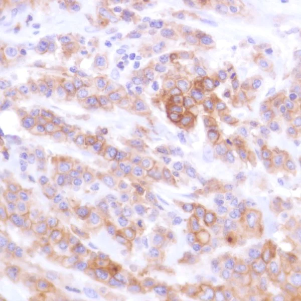 Immunohistochemistry (Formalin/PFA-fixed paraffin-embedded sections) - Anti-PD-L1 antibody [SP142] - C-terminal, BSA and Azide free (AB236238)