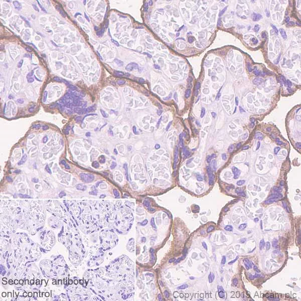 Immunohistochemistry (Formalin/PFA-fixed paraffin-embedded sections) - Anti-PD-L1 antibody [SP142] - C-terminal, BSA and Azide free (AB236238)