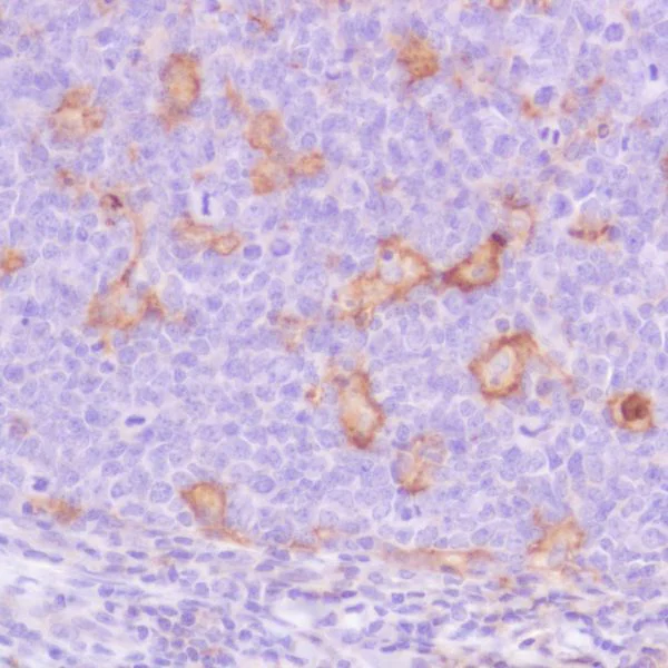 Immunohistochemistry (Formalin/PFA-fixed paraffin-embedded sections) - Anti-PD-L1 antibody [SP142] - C-terminal, BSA and Azide free (AB236238)