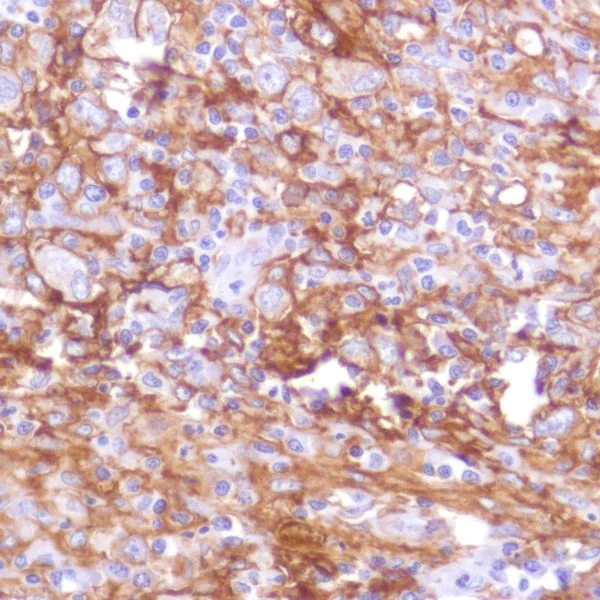 Immunohistochemistry (Formalin/PFA-fixed paraffin-embedded sections) - Anti-PD-L1 antibody [SP142] - C-terminal, BSA and Azide free (AB236238)