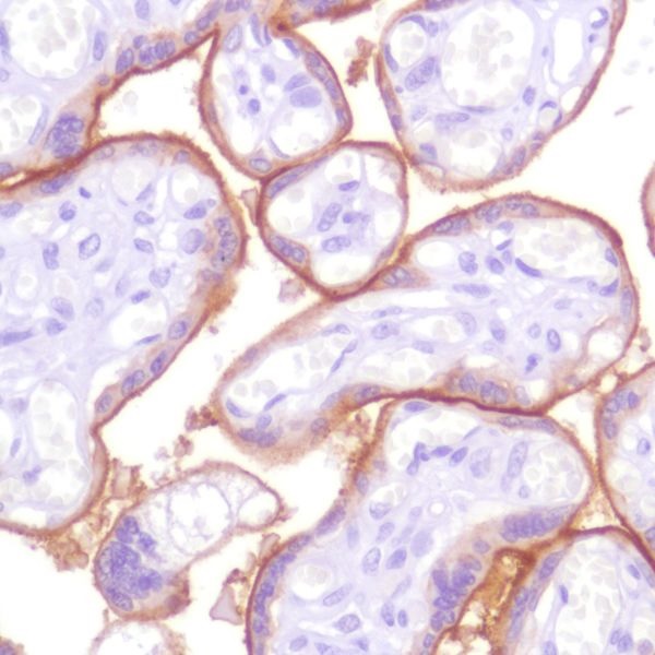 Immunohistochemistry (Formalin/PFA-fixed paraffin-embedded sections) - Anti-PD-L1 antibody [SP142] - C-terminal, BSA and Azide free (AB236238)