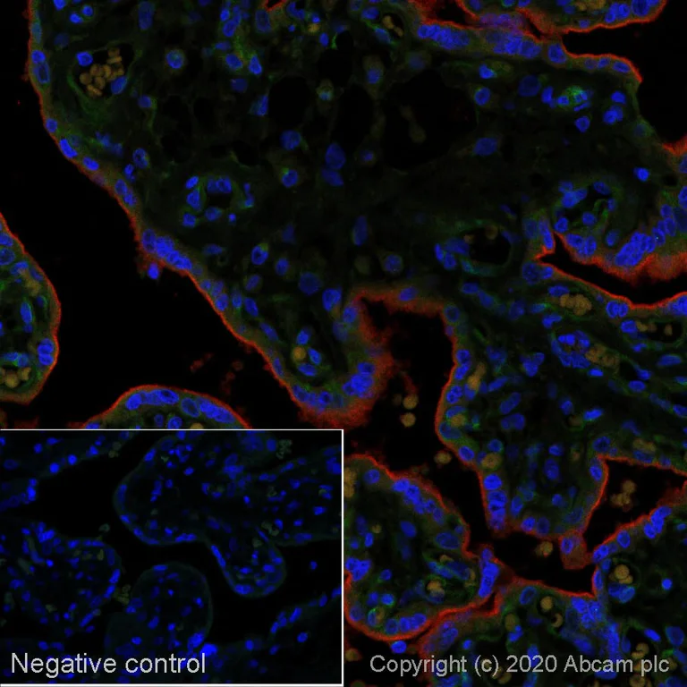 Immunohistochemistry (Formalin/PFA-fixed paraffin-embedded sections) - Anti-PD-L1 antibody [SP142] - C-terminal, BSA and Azide free (AB236238)