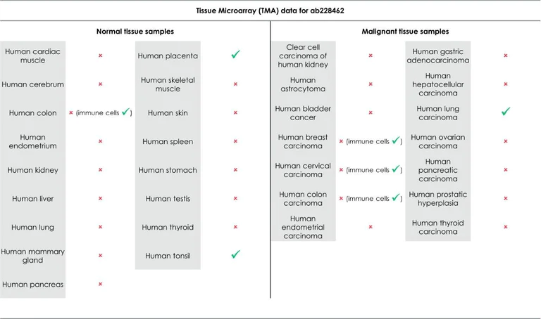Immunohistochemistry (Formalin/PFA-fixed paraffin-embedded sections) - Anti-PD-L1 antibody [SP142] - C-terminal, BSA and Azide free (AB236238)