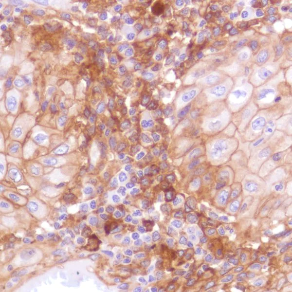 Immunohistochemistry (Formalin/PFA-fixed paraffin-embedded sections) - Anti-PD-L1 antibody [SP142] - C-terminal, BSA and Azide free (AB236238)