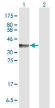 Western blot - Anti-PD-L2 antibody (AB169104)