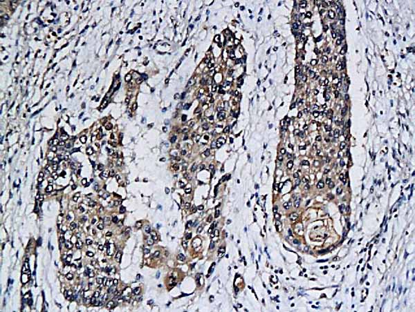 Immunohistochemistry (Formalin/PFA-fixed paraffin-embedded sections) - Anti-PD-L2 antibody (AB214221)