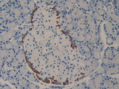 Immunohistochemistry (Formalin/PFA-fixed paraffin-embedded sections) - Anti-PD-L2 antibody (AB231145), expandable thumbnail