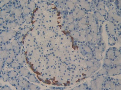 Immunohistochemistry (Formalin/PFA-fixed paraffin-embedded sections) - Anti-PD-L2 antibody (AB231145)
