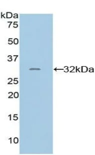 Western blot - Anti-PD-L2 antibody (AB231145)
